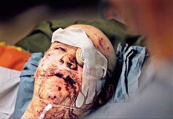 woundedsoldier_01.jpg